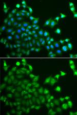 CBLC Antibody in Immunocytochemistry (ICC/IF)