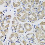 PSPH Antibody in Immunohistochemistry (Paraffin) (IHC (P))