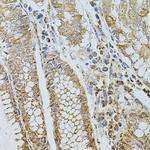 P-Selectin Antibody in Immunohistochemistry (Paraffin) (IHC (P))