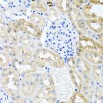 MYLK Antibody in Immunohistochemistry (Paraffin) (IHC (P))