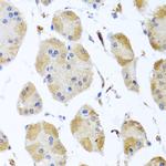 MYLK Antibody in Immunohistochemistry (Paraffin) (IHC (P))