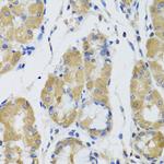 MST1 (STK4) Antibody in Immunohistochemistry (Paraffin) (IHC (P))