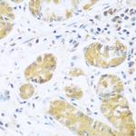 UCHL3 Antibody in Immunohistochemistry (Paraffin) (IHC (P))