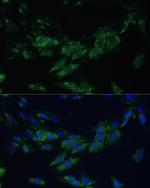 EphA4 Antibody in Immunocytochemistry (ICC/IF)