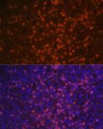 CD21 Antibody in Immunocytochemistry (ICC/IF)