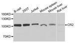 CD21 Antibody in Western Blot (WB)