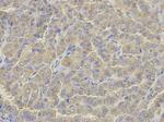 Glutamine Synthetase Antibody in Immunohistochemistry (Paraffin) (IHC (P))