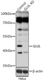 Glutamine Synthetase Antibody in Western Blot (WB)