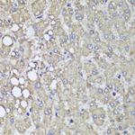 PIK3C2A Antibody in Immunohistochemistry (Paraffin) (IHC (P))