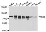 NUMB Antibody in Western Blot (WB)