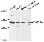 CD369 (Clec7a, Dectin-1) Antibody in Western Blot (WB)