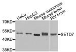 SETD7 Antibody in Western Blot (WB)