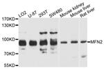 MFN2 Antibody in Western Blot (WB)