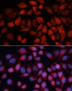 ACADM Antibody in Immunocytochemistry (ICC/IF)