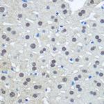 UBE1 Antibody in Immunohistochemistry (Paraffin) (IHC (P))