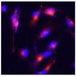 Nestin Antibody in Immunocytochemistry (ICC/IF)