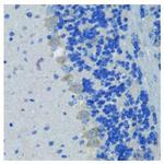 Nestin Antibody in Immunohistochemistry (Paraffin) (IHC (P))