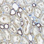 IP6K1 Antibody in Immunohistochemistry (Paraffin) (IHC (P))