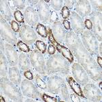 IP6K1 Antibody in Immunohistochemistry (Paraffin) (IHC (P))