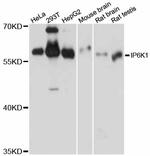 IP6K1 Antibody in Western Blot (WB)