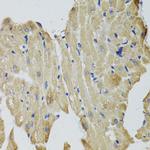 CKMT2 Antibody in Immunohistochemistry (Paraffin) (IHC (P))