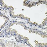 Aconitase 1 Antibody in Immunohistochemistry (Paraffin) (IHC (P))