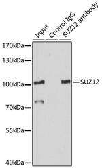 SUZ12 Antibody in Western Blot (WB)