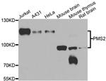 PMS2 Antibody in Western Blot (WB)