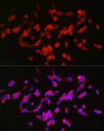 GAP43 Antibody in Immunocytochemistry (ICC/IF)