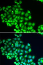 XPD Antibody in Immunocytochemistry (ICC/IF)