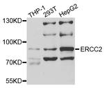 XPD Antibody in Western Blot (WB)