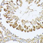 PSMA7 Antibody in Immunohistochemistry (Paraffin) (IHC (P))