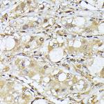 PSMA7 Antibody in Immunohistochemistry (Paraffin) (IHC (P))