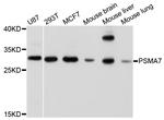 PSMA7 Antibody in Western Blot (WB)