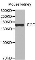 EGF Antibody in Western Blot (WB)