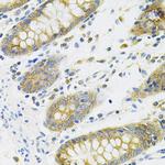 CD254 (RANK Ligand) Antibody in Immunohistochemistry (Paraffin) (IHC (P))