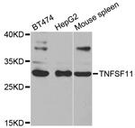 CD254 (RANK Ligand) Antibody in Western Blot (WB)