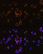 CD254 (RANK Ligand) Antibody in Immunocytochemistry (ICC/IF)