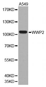 AIP2 Antibody in Western Blot (WB)