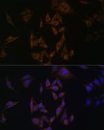 UBE2L6 Antibody in Immunocytochemistry (ICC/IF)