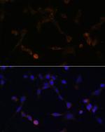 UBE2L6 Antibody in Immunocytochemistry (ICC/IF)