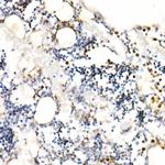 Neutrophil elastase Antibody in Immunohistochemistry (Paraffin) (IHC (P))