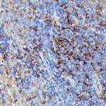 HLA-B Antibody in Immunohistochemistry (Paraffin) (IHC (P))