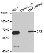 Catalase Antibody in Immunoprecipitation (IP)