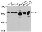 PP5 Antibody in Western Blot (WB)