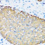 TSC1 Antibody in Immunohistochemistry (Paraffin) (IHC (P))