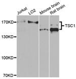 TSC1 Antibody in Western Blot (WB)