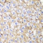 N-cadherin Antibody in Immunohistochemistry (Paraffin) (IHC (P))