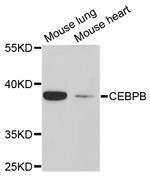 C/EBP beta Antibody in Western Blot (WB)