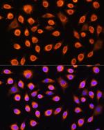 GNAS Antibody in Immunocytochemistry (ICC/IF)